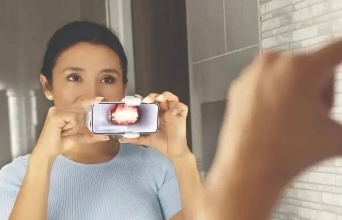 Patient using her smart phone at home to monitor the progress of her orthodontic aligners from Candid